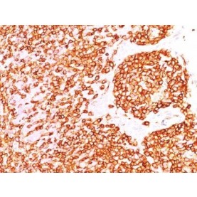 CD45RB(DF-B1), 1mg/mL
