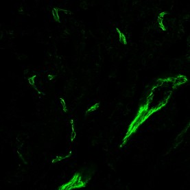 CD31 / PECAM-1(C31.3 + C31.7 + C31.10), 1mg/mL