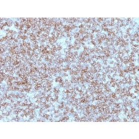 MHC II (HLA-DP) (beta chain)(Bra-14), 1mg/mL