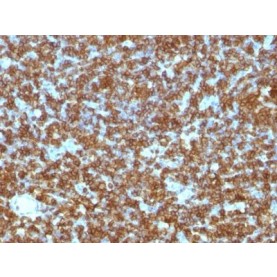 CD45RA(PTPRC/1131), 1mg/mL
