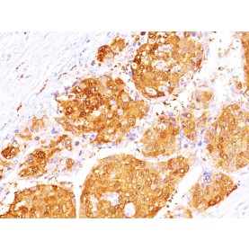 Biotium BNUM1143-50, Arginase 1 (Hepatocellular Carcinoma Marker)(ARG1/1125+ ARG1/1126), 1mg/mL