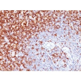 CD45RO(UCHL1 + T200/797), 1mg/mL