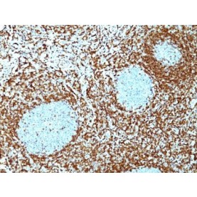 bcl-2(100/D5 + 124), 1mg/mL