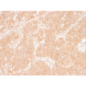 Adipophilin / Perilipin-2 (Marker of Obesity) (ADFP/1366), 1mg/mL
