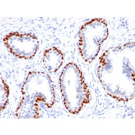 p63 (Squamous, Basal & Myoepithelial Cell Marker)(TP63/1423R), 1mg/mL