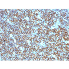 CD20 / MS4A1 (B-Cell Marker), 1mg/mL