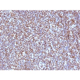 Biotium BNUM1504-50, ALK (Anaplastic Lymphoma Kinase) / CD246(ALK/1504), 1mg/mL