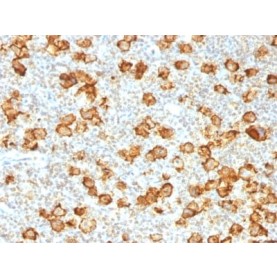 CD30 / TNFRSF8 (Hodgkin & Reed-Sternberg Cell Marker) (Ki-1/1505R), 1mg/mL