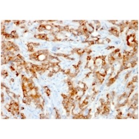 Biotium BNUM1537-50, Beta-2 Microglobulin (Renal Failure & Tumor Marker)(rB2M/961), 1mg/mL
