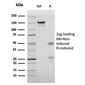 Biotium BNUM1538-50, Bromodeoxyuridine (BrdU) (Proliferation Marker)(rBRD469), 1mg/mL