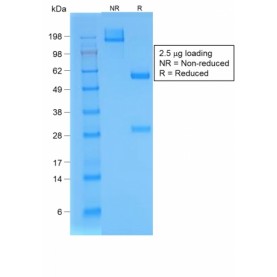 Biotium BNUM1539-50, Bromodeoxyuridine (BrdU) (Proliferation Marker)(BRD/1539R), 1mg/mL