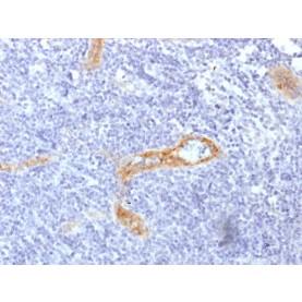 von Willebrand Factor / Factor VIII Related-Ag (Endothelial Marker)(rVWF/1465), 1mg/mL