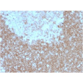 Biotium BNUM1557-50, CD268 / BAFFR / TNFRSF13C(BAFFR/1557), 1mg/mL