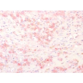 Tyrosinase-Related Protein-1 (TYRP-1) (Melanoma Marker), 1mg/mL
