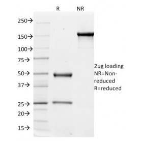 CD51 / Integrin V(ITGAV/1610), 1mg/mL