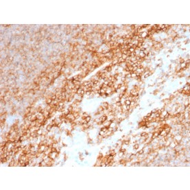 CD44 / HCAM Std.(BU75), 1mg/mL