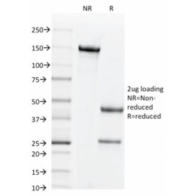 CD44v6 (Marker of Tumor Metastasis)(2F10), 1mg/mL