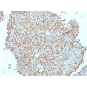 CD99 / MIC2 (Ewing's Sarcoma Marker), 1mg/mL