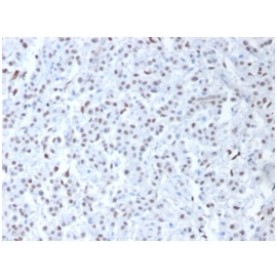 Wilm's Tumor 1 (WT1) (Wilm's Tumor & Mesothelial Marker), 1mg/mL
