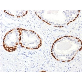 p63 (Squamous, Basal & Myoepithelial Cell Marker), 1mg/mL