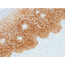 CD44v4 (Marker of Tumor Metastasis), 1mg/mL