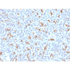 CFTR (Cystic Fibrosis Transmembrane Conductance Regulator)(N/A), 1mg/mL