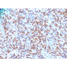 CD8A (Cytotoxic- & Suppressor T-Cell Marker)(N/A), 1mg/mL