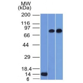 p63 (Squamous, Basal and Myoepithelial Cell Marker) (TP63/1786), 1mg/mL