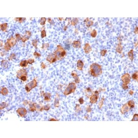 CD30 / TNFRSF8 (Hodgkin & Reed-Sternberg Cell Marker) (rKi-1/779), 1mg/mL