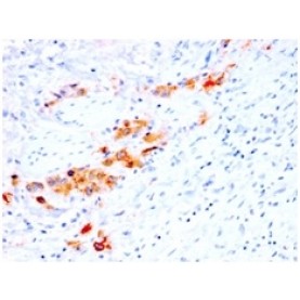 CD44v4 (Marker of Tumor Metastasis)(rCD44v4/1219), 1mg/mL