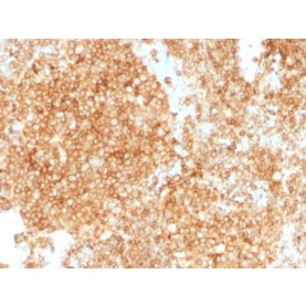 CD45 / LCA (Leucocyte Marker)(PTPRC/1147 + PTPRC/1460), 1mg/mL