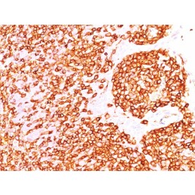 CD45 / LCA (B-Cell Marker)(rPTPRC/1460), 1mg/mL