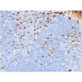 Human Kappa Light Chain (B-Cell Marker) (rL1C1), 1mg/mL