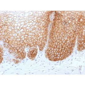 CD44v9 (Marker of Tumor Metastasis) (rCD44v9/1459), 1mg/mL