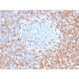CD5 (Mantle Cell Lymphoma Marker) (CD5/2416), 1mg/mL
