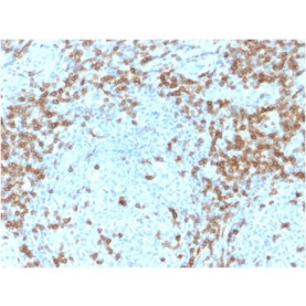 CD5 (Mantle Cell Lymphoma Marker)(CD5/2418), 1mg/mL