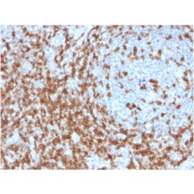 CD5 (Mantle Cell Lymphoma Marker)(CD5/2419), 1mg/mL