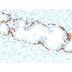 p63 (Squamous, Basal & Myoepithelial Cell Marker) (TP63/2428), 1mg/mL