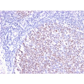 Biotium BNUM2497-50, Bcl-6 (Follicular Lymphoma Marker)(BCL6/2497R), 1mg/mL