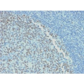 Biotium BNUM2498-50, Bcl-6 (Follicular Lymphoma Marker) (rBCL6/1718), 1mg/mL