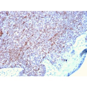 p73 (Tumor Suppressor)(P73/2531), 1mg/mL
