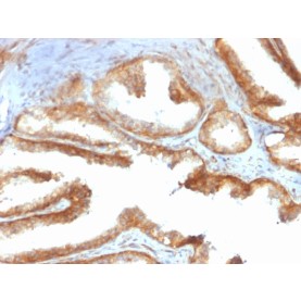 YBX1 / Y-box Binding Protein 1 / YB-1 (Tumor Biomarker)(rYBX1/2430), 1mg/mL
