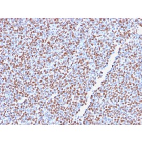 Biotium BNUM2766-50, ALK (Anaplastic Lymphoma Kinase) / CD246(ALK1/2766R), 1mg/mL