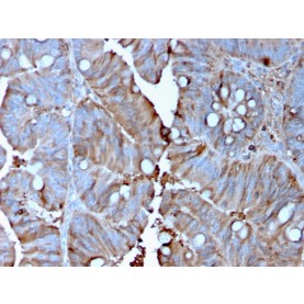 MerTK (Innate Immune Checkpoint)(MERTK/3015), 1mg/mL