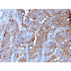 MerTK (Innate Immune Checkpoint)(MERTK/3022), 1mg/mL