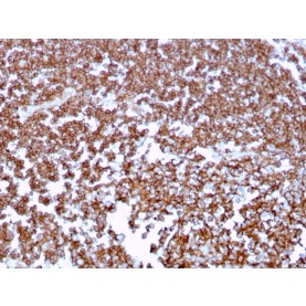 Biotium BNUM3409-50, CD20 / MS4A1 (B-Cell Marker)(MS4A1/3409), 1mg/mL