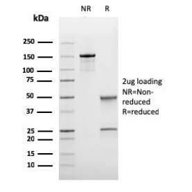 Biotium BNUM3433-50, Bcl-6 (Follicular Lymphoma Marker)(rBCL6/1475), 1mg/mL