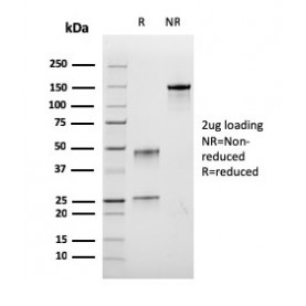 Biotium BNUM3464-50, Bromodeoxyuridine (BrdU) (Proliferation Marker)(rBRD.3), 1mg/mL