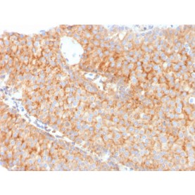PAI-RBP1 / SERBP1 / SERPINE1(SERBP1/3491), 1mg/mL