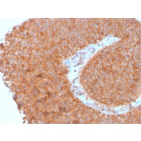 PAI-RBP1 / SERBP1 / SERPINE1(SERBP1/3495), 1mg/mL